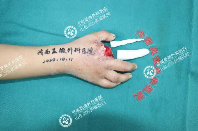 揭秘无名指的神秘面纱，它究竟是哪个手指？